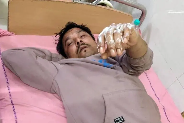 भांगड़ में फिर भड़की हिंसा, तृणमूल कार्यकर्ता पर बम से हमला