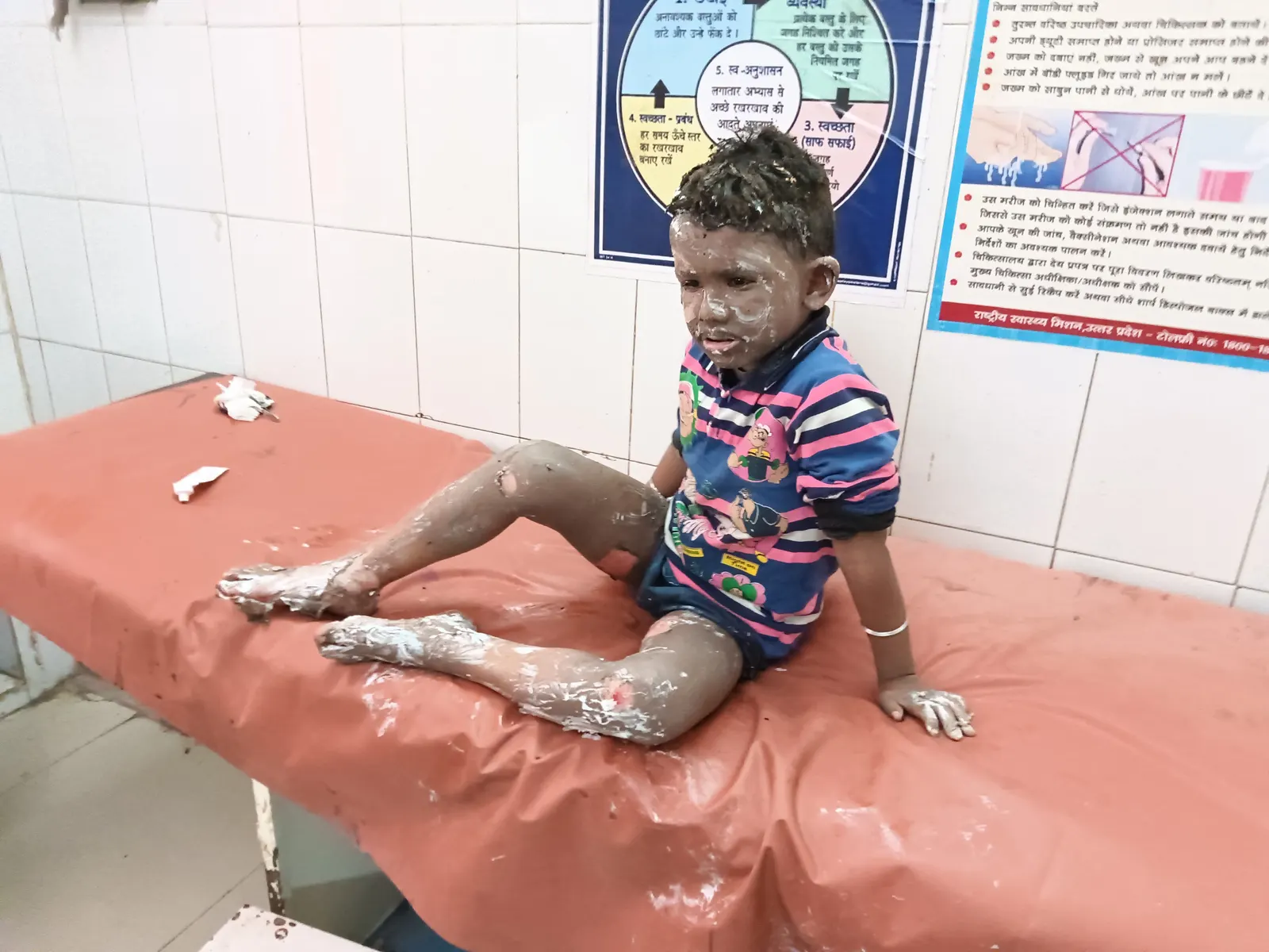 गैस का रेगुलेटर लीक होने से आग लगी, सात झुलसे