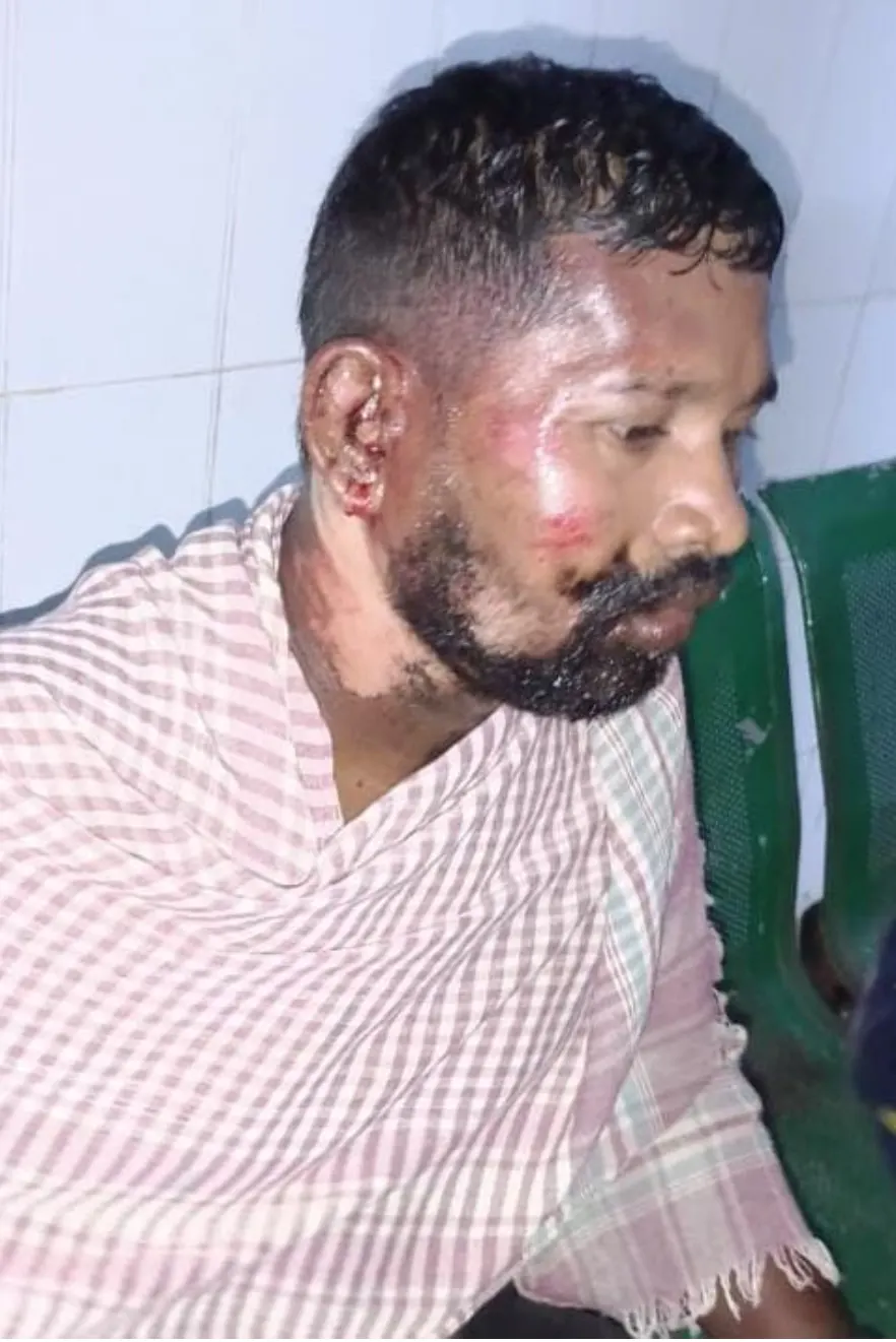 हाथियों के हमले में वन विभाग के तीन सदस्य घायल