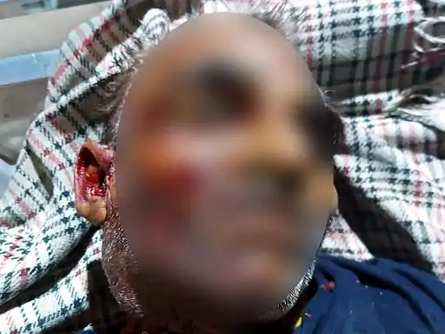फतेहाबाद में भतीजे ने पत्नी से अवैध सम्बंधों के शक में चाचा की गला काटकर की हत्या