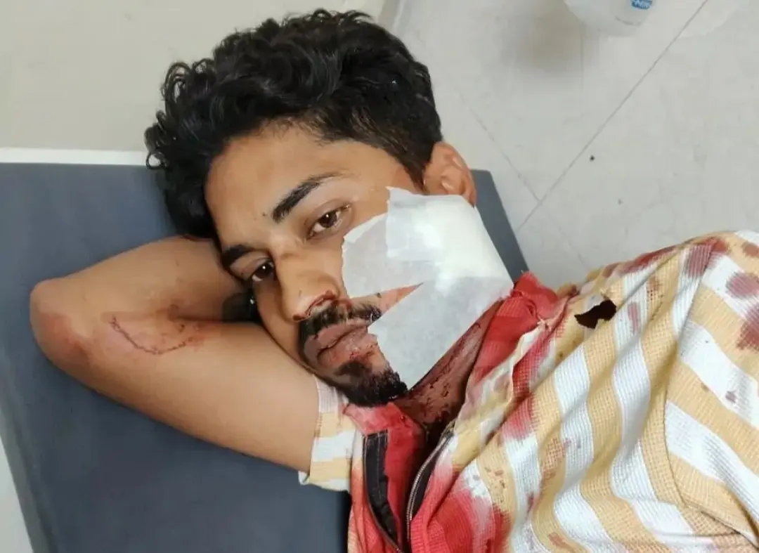 पानीपत में युवक ने अपने दोस्त के गले पर किया चाकू से प्रहार, हालत गंभीर