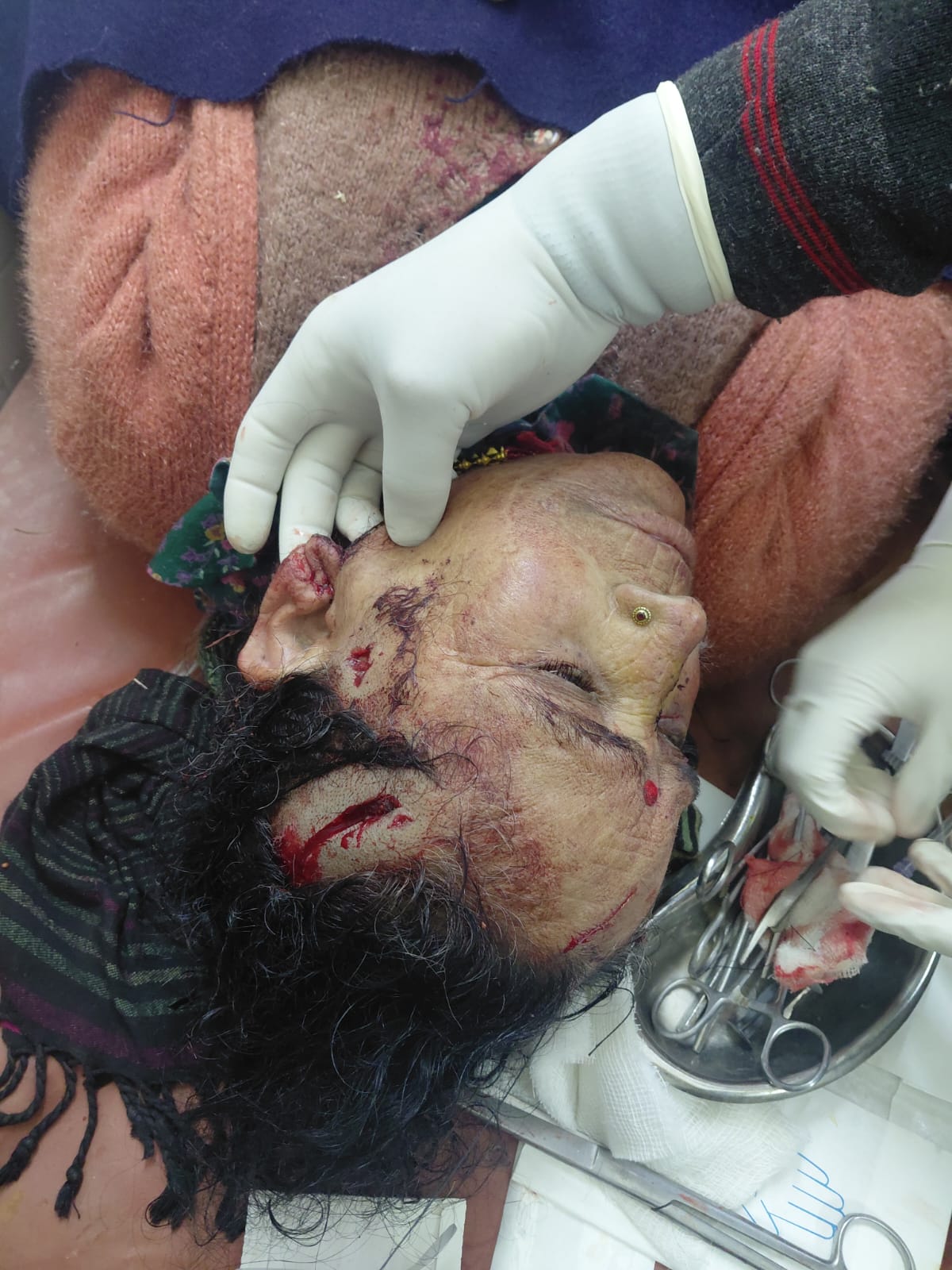 बड़कोट भालू के  हमले में महिला घायल , ग्रामीणों में दहशत